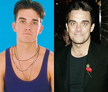 Robbie Williams в молодости и сейчас
